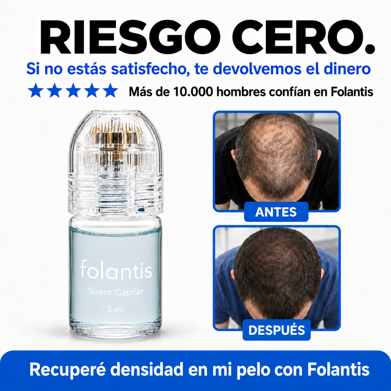FOLANTIS™ · MICROINFUSIÓN DE PÉPTIDOS