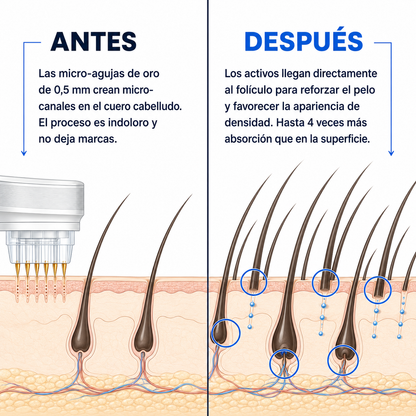 FOLANTIS™ · MICROINFUSIÓN DE PÉPTIDOS