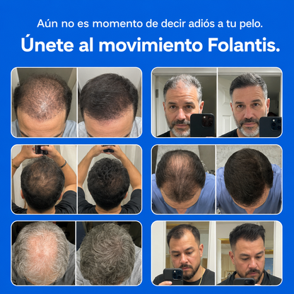 FOLANTIS™ · MICROINFUSIÓN DE PÉPTIDOS